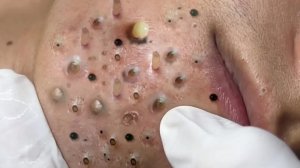 Успокаивающий уход за лицом для снятия стресса в люкс-спа 🌿 Обретите внутренний покой