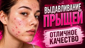 🔴 УДАЛЕНИЕ ПРЫЩЕЙ ОНЛАЙН | Чистка лица, чёрные точки, акне — LIVE-эфир