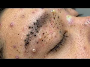 Успокаивающий массаж лица для снятия стресса в спа