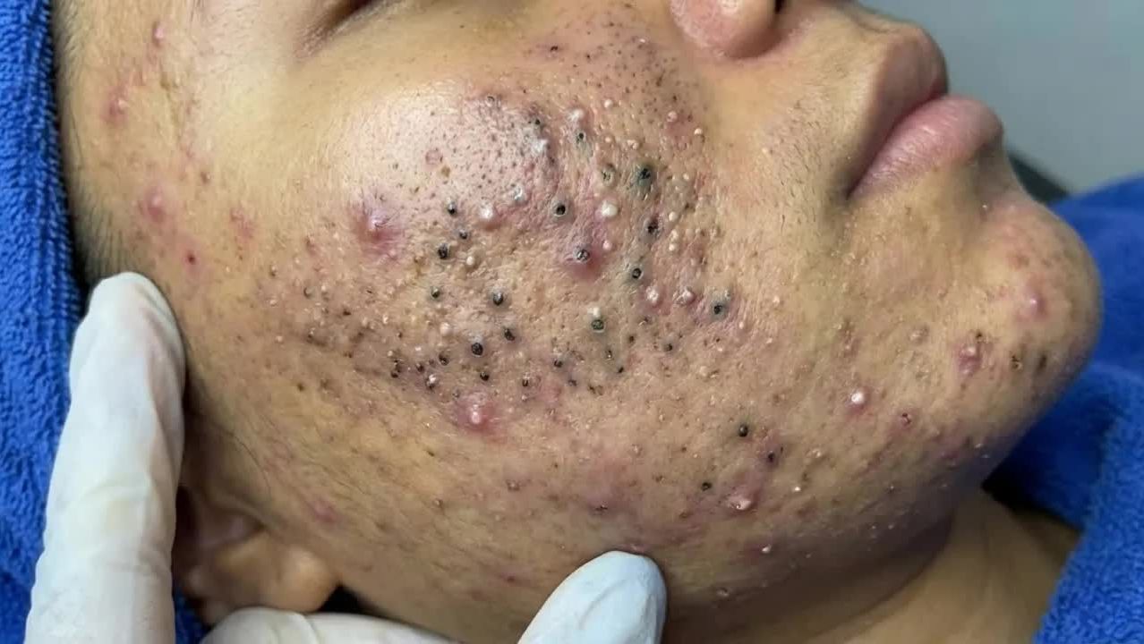 Наслаждайтесь каждым днем вместе с Loan Nguyen Spa Beauty | Новое видео смотреть онлайн