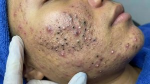 Наслаждайтесь каждым днем вместе с Loan Nguyen Spa Beauty | Новое видео