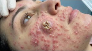 🌾 Очищение и омоложение кожи с помощью лица