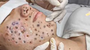 Успокаивающий уход за лицом для снятия стресса в спа-салоне