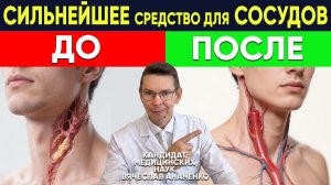 СОСУДЫ И СЕРДЦЕ ВОССТАНОВЯТСЯ У ВСЕХ!