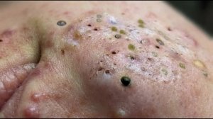 Успокаивающий уход за лицом для снятия стресса в спа-салоне