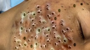 Советы по очищению и уходу за лицом