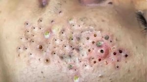 Успокаивающий уход за лицом для снятия стресса в спа-салоне