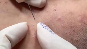 Успокаивающий уход за лицом для снятия стресса в спа-салоне