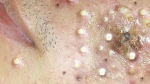 Успокаивающий уход за лицом для снятия стресса в спа-салоне 🌿 Достигни внутренней гармонии