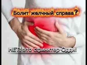 болит справа это желчный? НЕТ! это сфинктер Одди