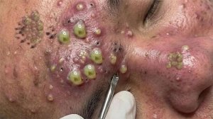 Успокаивающий уход за лицом для снятия стресса в спа-салоне