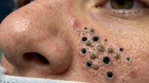 Успокаивающий уход за лицом для снятия стресса в спа