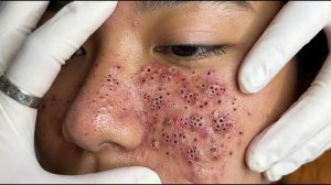 Успокаивающий уход за лицом для снятия стресса в спа-салоне