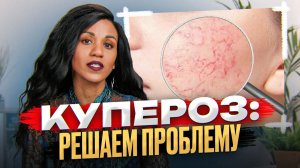 Купероз: решаем проблему // Сосуды на лице // Красное лицо // Телеангиэктазии