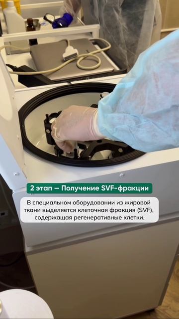 Как проходит SVF-терапия?