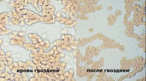 Как изменилась кровь после употребления молотой гвоздики.