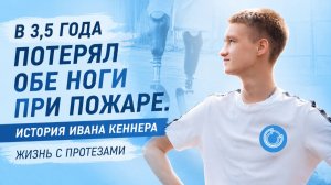 В 3,5 года потерял обе ноги при пожаре. История Ивана Кеннера | Жизнь с протезами