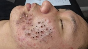 Расслабляющий уход за лицом для снятия стресса в спа
