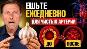 Ешьте ЭТО каждый день для очищения сосудов от бляшек
