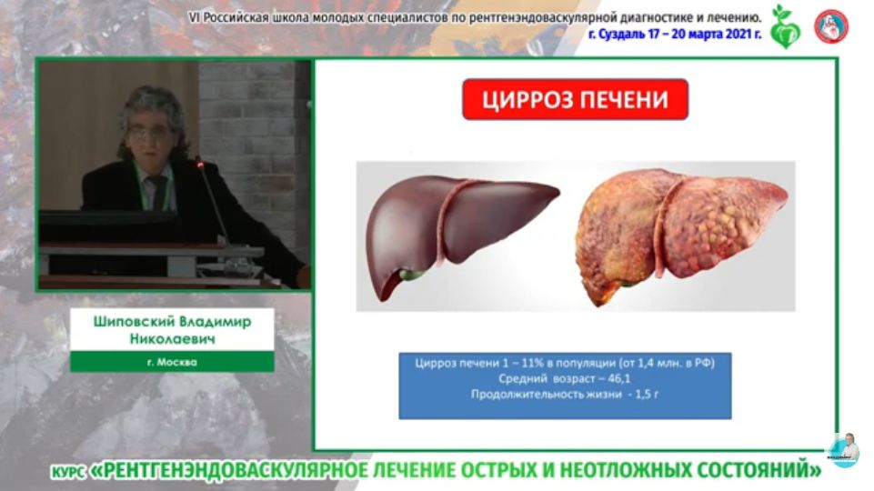 Портальная гипертензия (диагностика и лечение). Взгляд эндоваскулярного хирурга