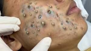 Успокаивающий массаж лица для снятия стресса в спа-салоне