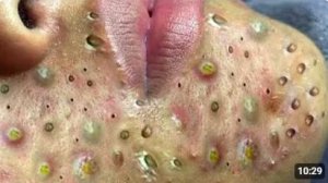 ОТ ЧЁРНЫХ ТОЧЕК ДО ЧИСТОЙ КОЖИ КОРЕЯ