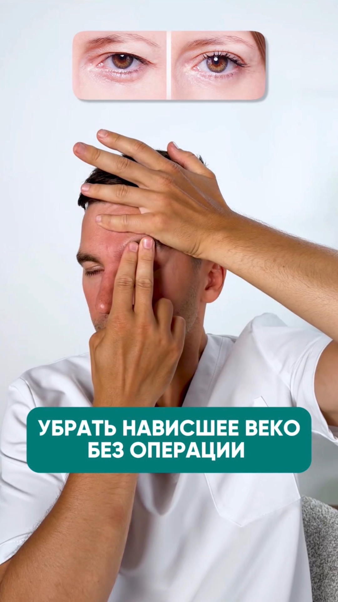 Убрать нависшее веко БЕЗ ОПЕРАЦИИ? Вот как это сделать! #лицо #веко #омоложение