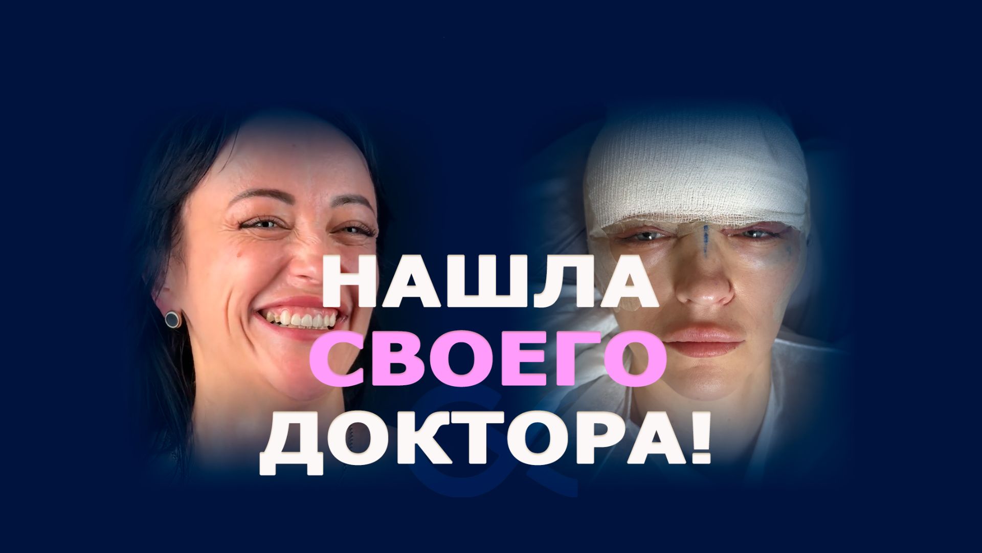 Верхняя блефаропластика и эндоскопическая подтяжка лба