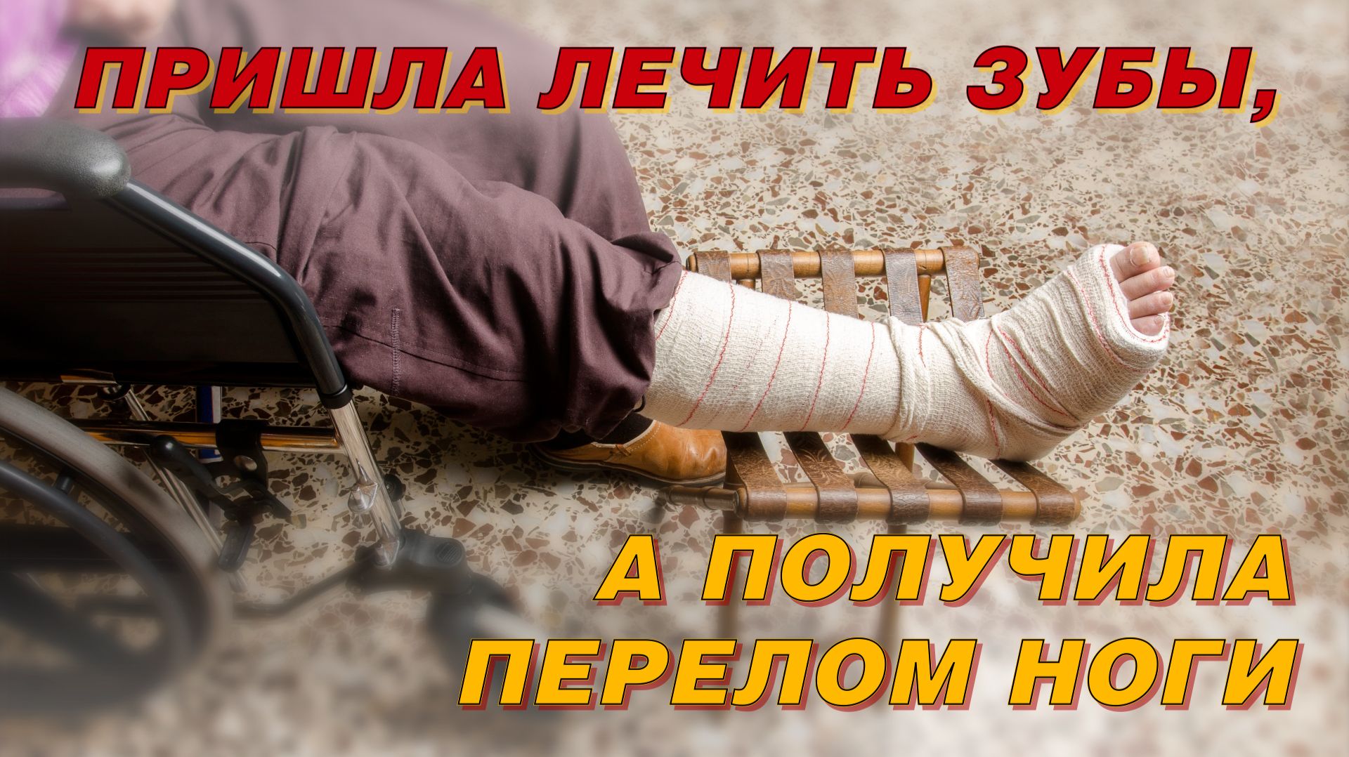 Пришла лечить зубы, а получила перелом ноги