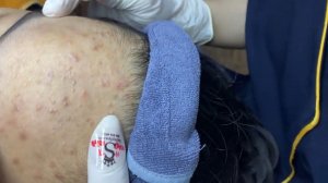 328 • Acne collection • АСМР • Relax Spa