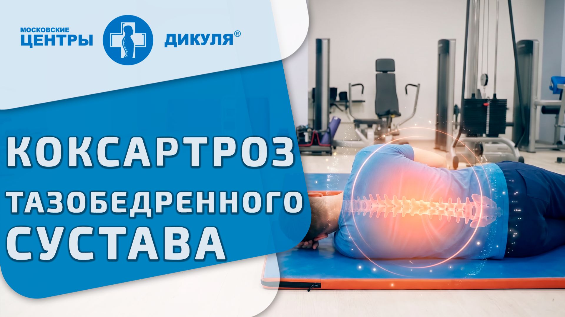 🏥 Коксартроз тазобедренного сустава какие упражнения возвращают подвижность. Коксартроз тазобедренн