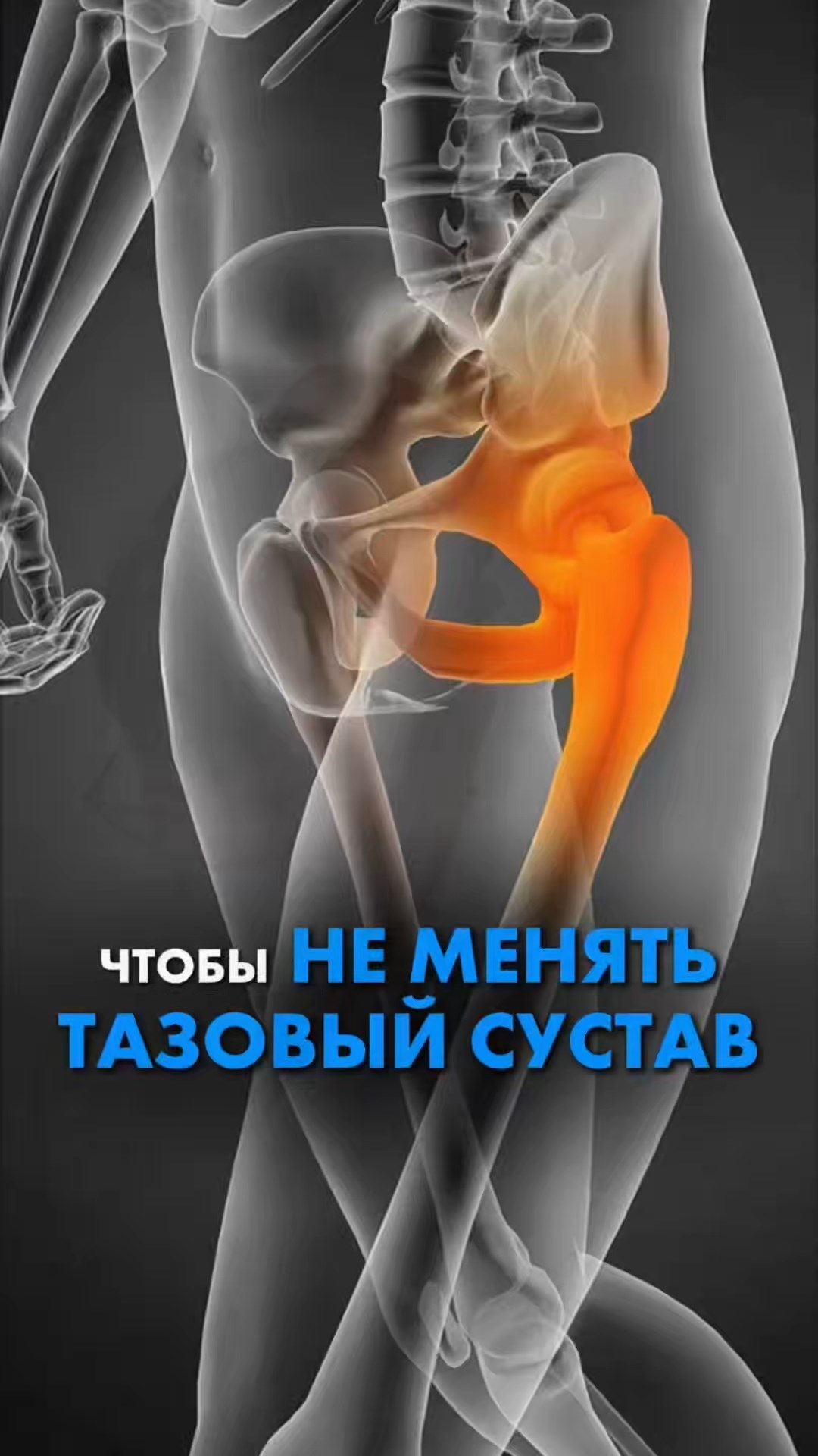 ЧТОБЫ НЕ МЕНЯТЬ ТАЗОВЫЙ СУСТАВ смотреть онлайн