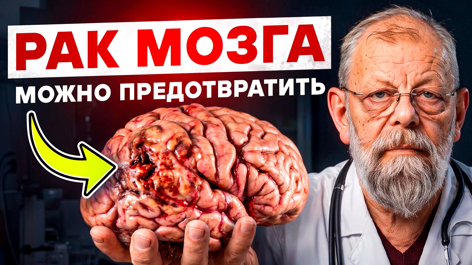ЭТИ ЗНАМЕНИТОСТИ С МИЛЛИОНАМИ НЕ СПАСЛИСЬ ОТ РАКА. ЧТО ДЕЛАТЬ ОБЫЧНОМУ ЧЕЛОВЕКУ?