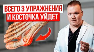 Артроз БОЛЬШОГО ПАЛЬЦА ноги. Как вернуть ПОДВИЖНОСТЬ пальцу за 15 минут дома