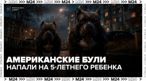 Жительница деревни Павловское рассказала подробности нападения собаки на ребенка - Москва 24