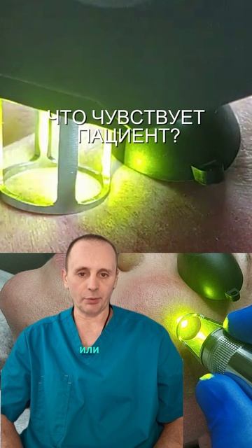 Лазерное лечение розацеа и купероза: реальная процедура Лазерное лечение розацеа и купероза: реальная процедура