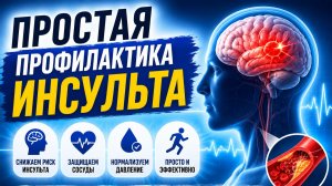Инсульт начинается с шеи? Простая профилактика, о которой не говорят