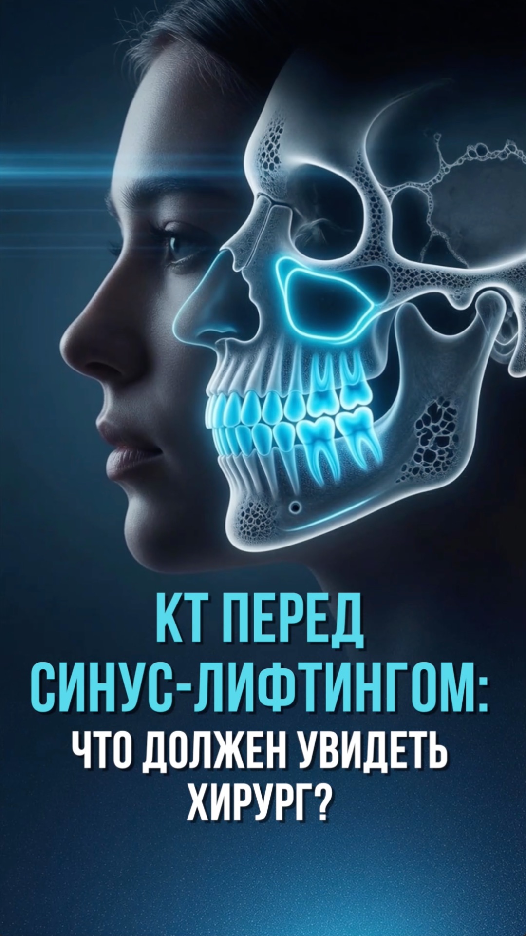 КТ перед синус-лифтингом: почему 2D-снимка недостаточно. Какие факторы риска видны на снимке