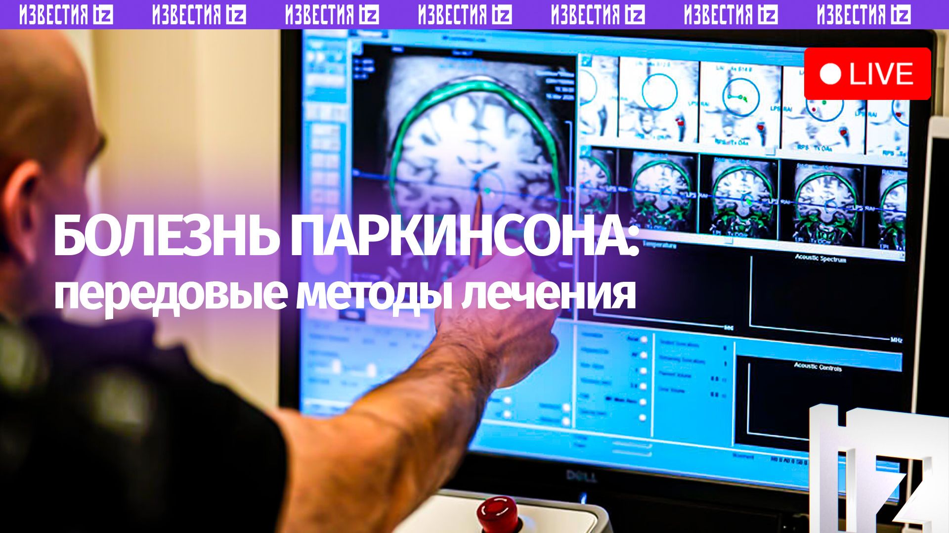 Передовые методы лечения болезни Паркинсона обсуждают в пресс-центре МИЦ «Известия» смотреть онлайн