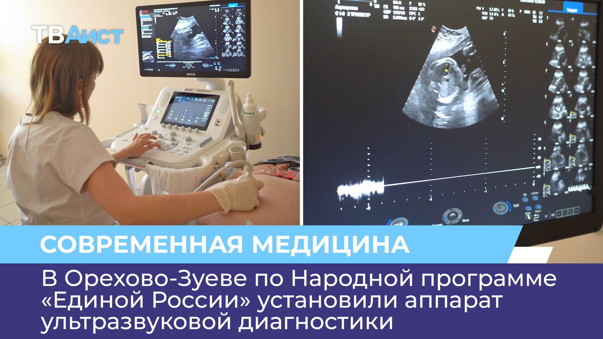 В Орехово-Зуеве по Народной программе «Единой России» установили аппарат ультразвуковой диагностики