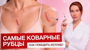 Как избавиться от келоидных рубцов?