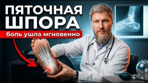 ПЯТОЧНАЯ ШПОРА ушла навсегда – Это решается за 15 МИНУТ
