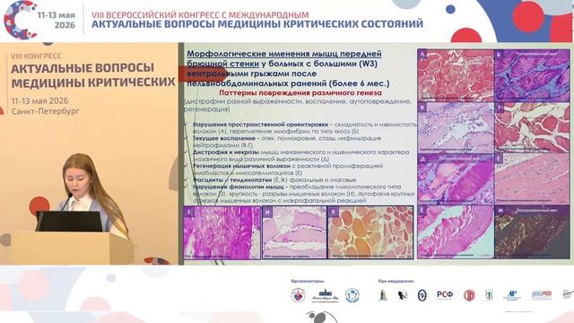 Хирургическая реабилитация после пельвиоабдоминальных ранений Балюра О.В. смотреть онлайн