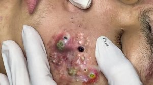 Делимся советами по очищению и уходу за кожей лица