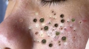 Расслабляющий уход за кожей: очищение 🧖