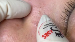 360 • Acne collection • АСМР • Relax Spa