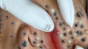 Успокаивающая процедура для лица, снимающая стресс