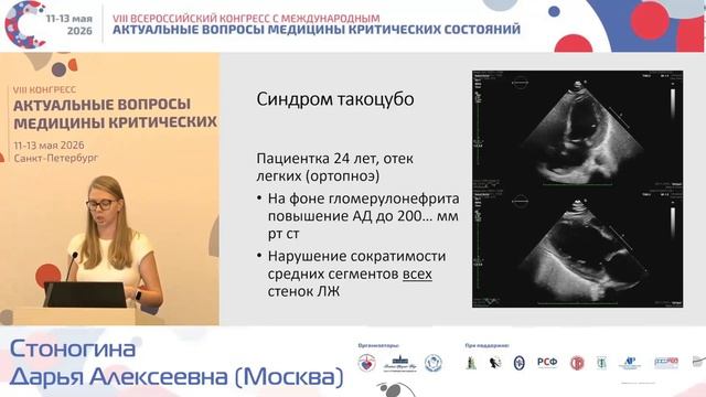 Одышка и ЭХО кардиография Стоногина Д. А. 2026 смотреть онлайн