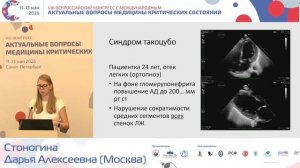 Одышка и ЭХО кардиография Стоногина Д. А. 2026