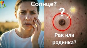 Родинки, пигменты на коже. Опасны?